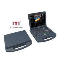 2021 cheap laptop 3D/4D Color ultrasound portable ultrasound machine echo doppler